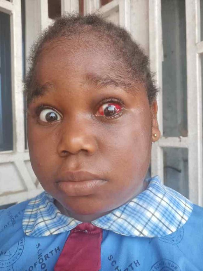 How Landlord damaged tenant’s daughter’s eyes with Sniper over unpaid rent